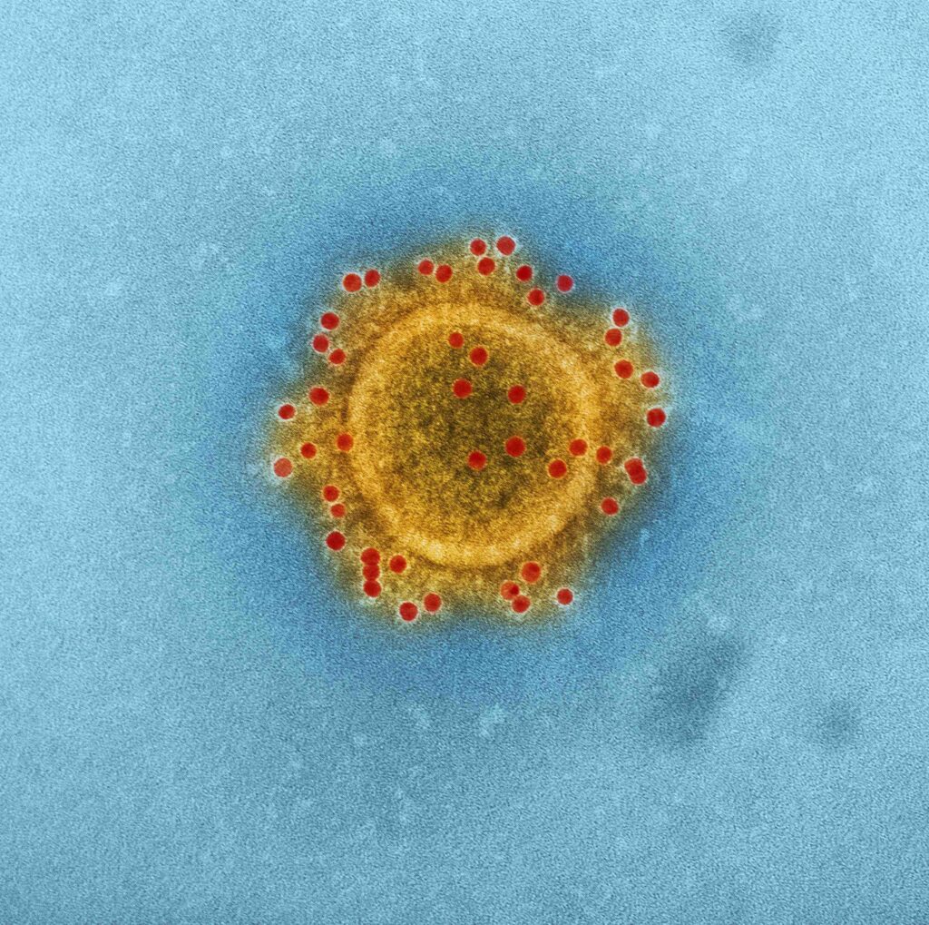 Colorized image of the MERS coronavirus.