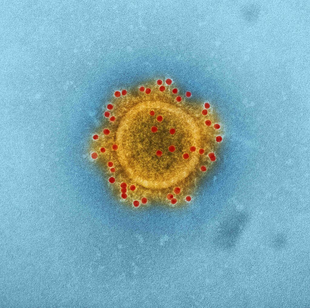 Stop Calling the Coronavirus Outbreak a Black Swan Colorized image of the MERS coronavirus.